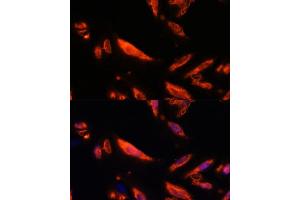 Immunofluorescence analysis of U-2 OS cells using LRRC7 antibody (ABIN6128203, ABIN6143347, ABIN6143348 and ABIN6216986) at dilution of 1:100.