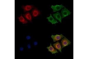 ABIN7094366 and ABIN7098413 staining HepG2 cells by IF/ICC. (KIAA0391 Antikörper  (Internal Region))