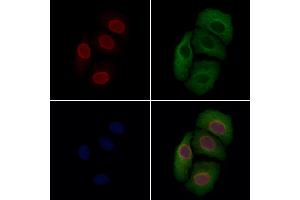 MUM1 Antibody staining Hela cells by IF/ICC.