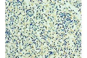 Immunohistochemistry of paraffin-embedded human spleen tissue using ABIN7166935 at dilution of 1:100 (RSPO1 Antikörper  (AA 21-263))