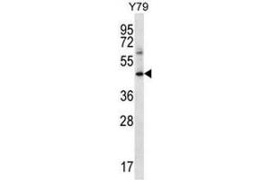 IFNGR1 Antibody (C-term) western blot analysis in Y79 cell line lysates (35µg/lane). (IFNGR1 Antikörper  (C-Term))