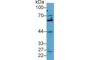 Western blot analysis of Human MCF7 cell lysate, using Mouse Smad4 Antibody (2 µg/ml) and HRP-conjugated Goat Anti-Rabbit antibody ( (SMAD4 Antikörper  (AA 9-231))