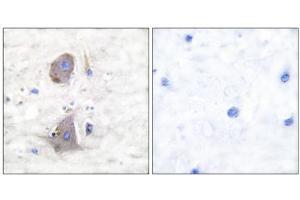 Immunohistochemical analysis of paraffin-embedded human brain tissue using GLUT1 antibody (ABIN5976416). (GLUT1 Antikörper  (C-Term))