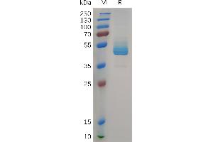 Human CD3E Protein, hFc Tag on SDS-PAGE under reducing condition.