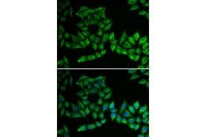 Immunofluorescence analysis of U2OS cells using TPMT antibody . (TPMT Antikörper  (AA 1-245))