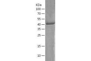 Medium-Chain Specific Acyl-CoA Dehydrogenase, Mitochondrial (MCAD) (AA 26-421) protein (His tag)