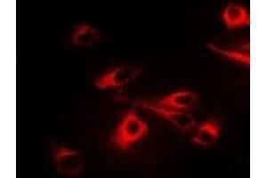 Immunofluorescent analysis of CCT2 staining in A549 cells. (CCT2 Antikörper)