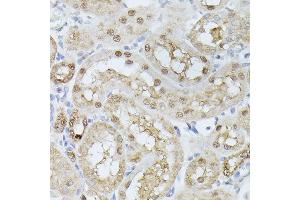 Immunohistochemistry of paraffin-embedded rat kidney using TPI1 antibody (ABIN7270977) at dilution of 1:100 (40x lens). (TPI1 Antikörper  (AA 1-249))