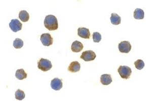 Immunocytochemistry of TLR9 in Jurkat cells with this product at 2 μg/ml. (TLR9 Antikörper  (Center))