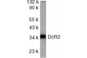 Image no. 1 for anti-Tumor Necrosis Factor Receptor Superfamily, Member 10d, Decoy with Truncated Death Domain (TNFRSF10D) (AA 249-263) antibody (ABIN201906) (DcR2 Antikörper  (AA 249-263))