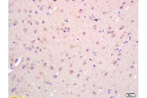 Formalin-fixed and paraffin embedded rat brain labeled with Rabbit Anti EphA2/Eph receptor A2 Polyclonal Antibody, Unconjugated (ABIN669201) at 1:200 followed by conjugation to the secondary antibody and DAB staining