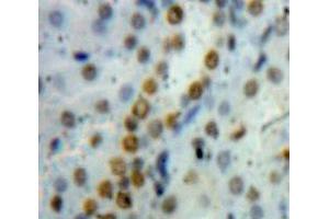 IHC-P analysis of Kidney Tissue, with DAB staining. (HMGB1 Antikörper  (AA 1-215))