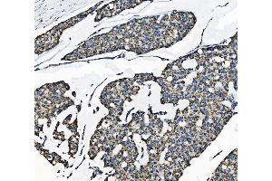 IHC analysis of TOMM70 using anti-TOMM70 antibody (ABIN7599855).
