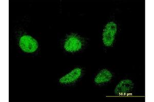 Immunofluorescence of monoclonal antibody to CSDC2 on HeLa cell. (CSDC2 Antikörper  (AA 1-153))