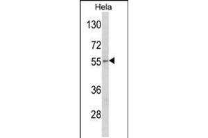 Western blot analysis of DFNA5 Antibody in Hela cell line lysates (35ug/lane) (DFNA5 Antikörper  (N-Term))