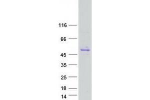 Validation with Western Blot (GNAS Protein (Transcript Variant 1) (Myc-DYKDDDDK Tag))