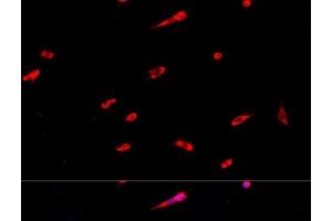 Immunofluorescence analysis of PC-12 cells using EIF3J Polyclonal Antibody at dilution of 1:100. (EIF3S1 Antikörper)