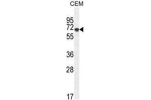AMY2B Antibody (N-term) western blot analysis in CEM cell line lysates (35µg/lane).