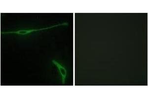 Immunofluorescence analysis of NIH-3T3 cells, using LAMA2 Antibody. (Laminin Antikörper  (AA 2011-2060))