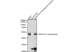 Immunoprecipitation analysis of 300 μg extracts of 293T cells using 3 μg SARS-CoV-2 Nucleoprotein antibody (ABIN7269053). (SARS-CoV-2 Envelope Antikörper)