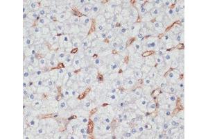 Immunohistochemistry of paraffin-embedded Human liver using CD36 Polyclonal Antibody at dilution of 1:200 (40x lens). (CD36 Antikörper)