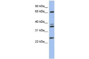 WB Suggested Anti-ATP6V1A Antibody Titration: 0. (ATP6V1A Antikörper  (N-Term))
