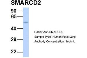 Host:  Rabbit  Target Name:  SMARCD2  Sample Type:  Human Fetal Lung  Antibody Dilution:  1. (SMARCD2 Antikörper  (Middle Region))