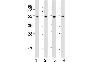 Western blot testing of human 1) Raji, 2) K562, 3) Jurkat and 4) HeLa cell lysate with HSP60 antibody. (HSPD1 Antikörper  (AA 80-109))