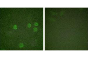 Forskolin + -Immunofluorescence analysis of HeLa cells, treated with Forskolin (40nM, 30mins), using Cyclin B1 (Ab-126) antibody (#BOO68). (Cyclin B1 Antikörper  (Ser126))