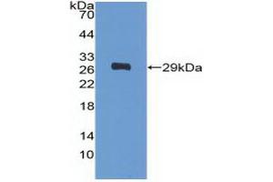 Detection of Recombinant PDGFRa, Human using Polyclonal Antibody to Platelet Derived Growth Factor Receptor Alpha (PDGFRa) (PDGFRA Antikörper  (AA 170-387))