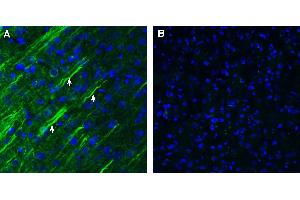 Expression of SSTR1 in rat parietal cortex.