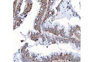 IHC analysis of PPA2 using anti-PPA2 antibody (ABIN6719431).