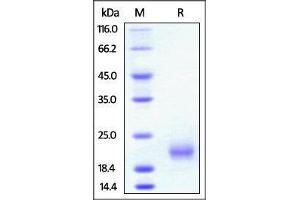 Rat GITR, His Tag on SDS-PAGE under reducing (R) condition. (TNFRSF18 Protein (AA 20-121) (His tag))