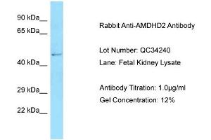Host: Rabbit Target Name: AMDHD2 Sample Type: Fetal Kidney Antibody Dilution: 1. (AMDHD2 Antikörper  (N-Term))