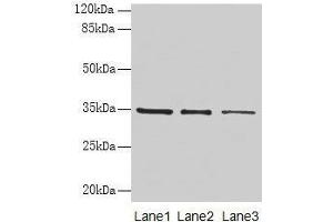 Western blot All lanes: GDF15 antibody at 4 μg/mL Lane 1: HepG2 whole cell lysate Lane 2: Human placenta tissue Lane 3: A549 whole cell lysate Secondary Goat polyclonal to rabbit IgG at 1/10000 dilution Predicted band size: 35 kDa Observed band size: 35 kDa (GDF15 Antikörper  (AA 198-308))