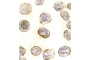 Immunocytochemistry of DAXX in HeLa cells with AP30275PU-N DAXX antibody at 10 μg/ml. (DAXX Antikörper  (C-Term))