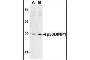 Western blot analysis of TP53INP1 expression in Human lung tissue lysate with AP30639PU-N TP53INP1 antibody at 0.