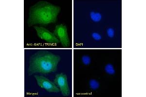 ABIN184913 Immunofluorescence analysis of paraformaldehyde fixed U2OS cells, permeabilized with 0.