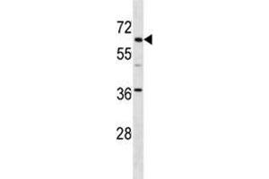 TFE3 antibody western blot analysis in mouse kidney tissue lysate. (TFE3 Antikörper  (AA 489-516))