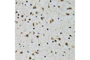 Immunohistochemistry of paraffin-embedded rat brain using SLC23A2 antibody (ABIN2559957) at dilution of 1:100 (40x lens). (SLC23A2 Antikörper)