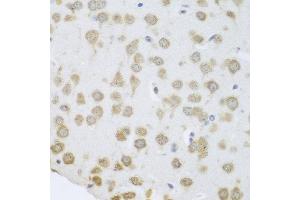 Immunohistochemistry of paraffin-embedded mouse brain using GRPEL2 antibody at dilution of 1:100 (40x lens).