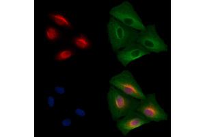 ABIN7094643 and ABIN7098693 staining  cells by IF/ICC. (SALL1 Antikörper  (N-Term))