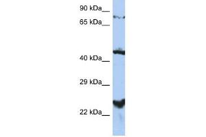 MRS2L antibody used at 1 ug/ml to detect target protein. (MRS2 Antikörper  (Middle Region))