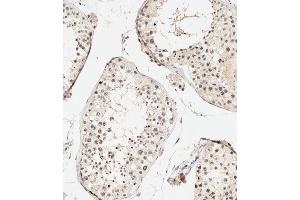 Immunohistochemical analysis of paraffin-embedded human testis tissue using (ABIN388841 and ABIN2839148) performed on the Leica® BOND RXm. (UBE4B Antikörper  (N-Term))