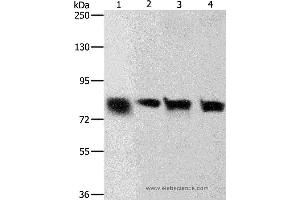 Western blot analysis of Hela and A549 cell, human liver cancer tissue and HT-29 cell, using CDH6 Polyclonal Antibody at dilution of 1:500 (CDH6 Antikörper)