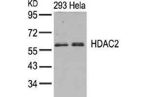 Image no. 3 for anti-Histone Deacetylase 2 (HDAC2) (AA 392-396) antibody (ABIN197336) (HDAC2 Antikörper  (AA 392-396))