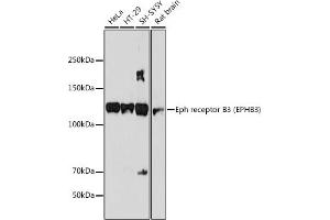 Western blot analysis of extracts of various cell lines, using Eph receptor B3 (EPHB3) (EPHB3) antibody (ABIN7266972) at 1:1000 dilution. (EPH Receptor B3 Antikörper)