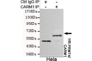 Immunoprecipitation analysis of Hela cell lysates using PRMT4/CARM1 mouse mAb. (CARM1 Antikörper)