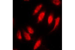 Immunofluorescent analysis of SMAD2 (pS467) staining in HeLa cells.