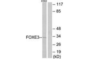 Western blot analysis of extracts from K562 cells, using FOXE3 Antibody.